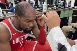 小帅更帅了！ai恶搞：杜兰特植发补齐了发际线！