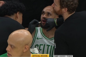 看着就疼！内姆哈德上篮一肘打到怀特下巴&后者嘴巴出血 不是恶犯