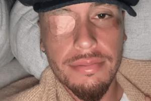 早日康复！奥坎波斯遭遇单侧面瘫，病因可能与病毒感染有关