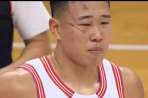 贺希宁谈脸部被划伤：第一节视力的确有影响 现场头很晕 问题不大