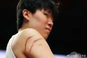 好长的血道子！杨瀚森工作室：是伤痕 也是成长路上的拼搏勋章